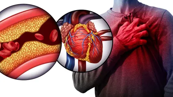 Kaempferol and Quercetin on cardiovascular disease