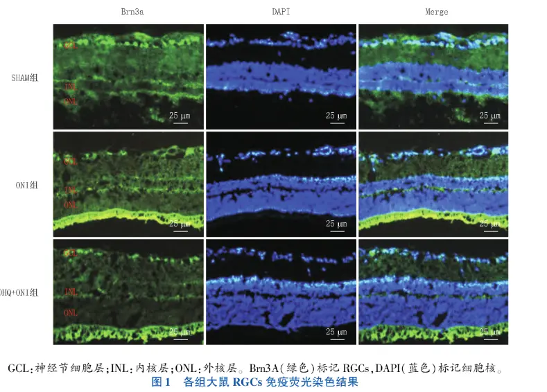 Immunofluorescence staining results of RGCs in each group of rats Immunofluorescence staining results of RGCs in each group of rats