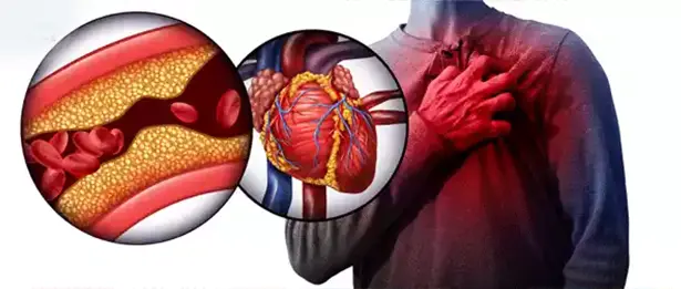 cardiovascular condition