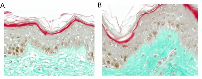The Main Effects of Asiaticoside Powder The Main Effects of Asiaticoside Powder