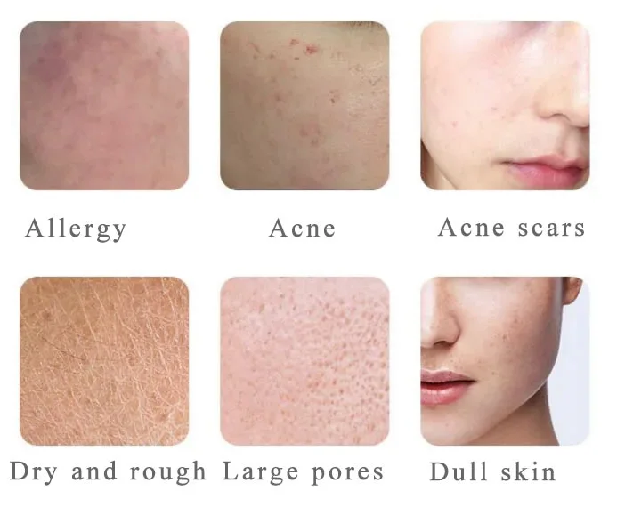 Applicable Symptoms of Centella Asiatica Extract