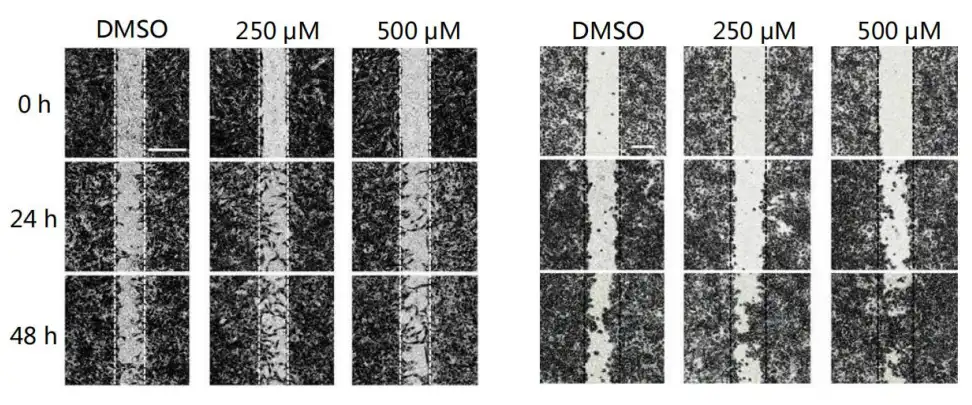 Madecassoside powder (250-500 μM) can promote cell migration and accelerate wound repair. Madecassoside powder (250-500 μM) can promote cell migration and accelerate wound repair.