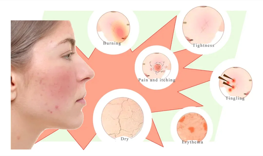 What skin is Asiaticoside suitable for?