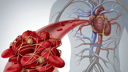Vascular Health Vascular Health