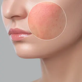 anti-inflammatory anti-inflammatory