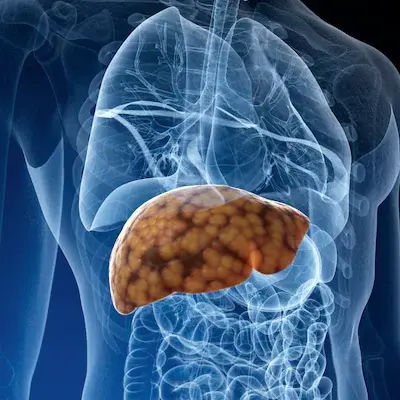 protect the liver protect the liver