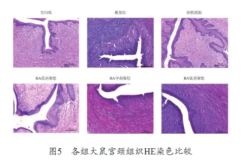 Anti-cervicitis effect and mechanism of rosmarinic acid Anti-cervicitis effect and mechanism of rosmarinic acid