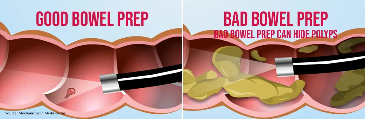 Senna Leaf Extract Benefits