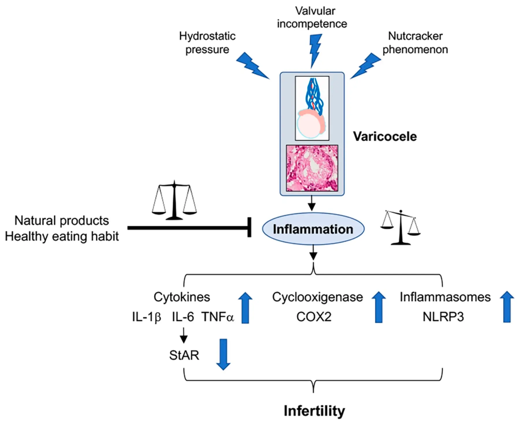 Horse Chestnut Extract Benefits Horse Chestnut Extract Benefits