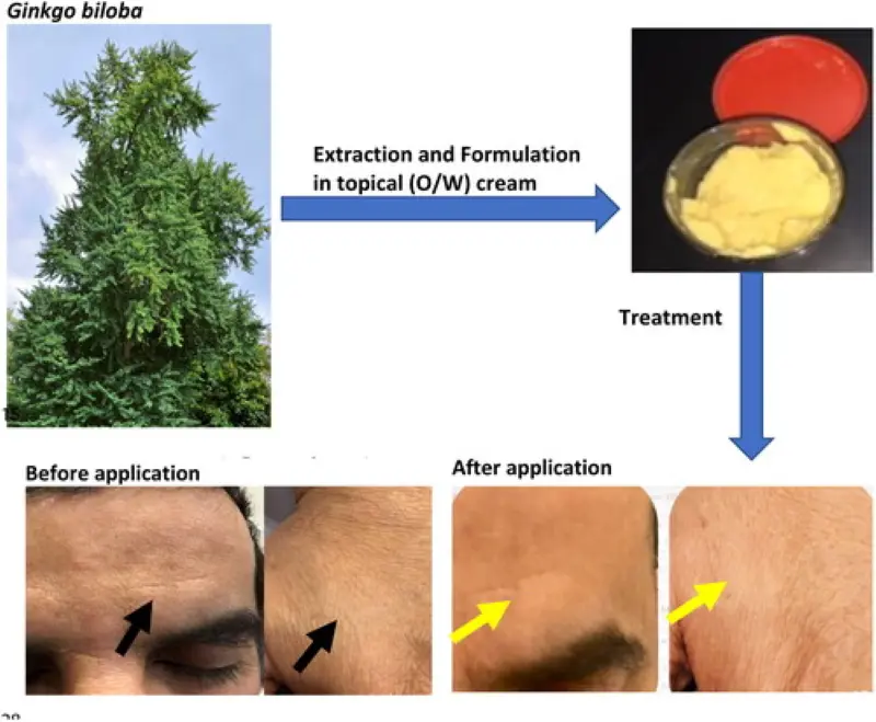 Skin-Beneficial Properties of Ginkgo Biloba Extract