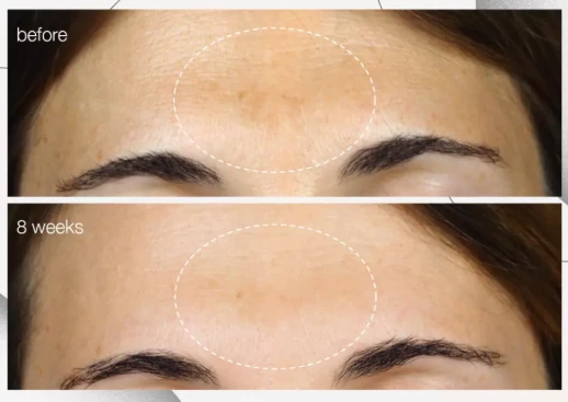 Holy Basil Extract For Hyperpigmentation Holy Basil Extract For Hyperpigmentation