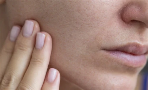 Echinacea Purpurea Extract Skin Benefits