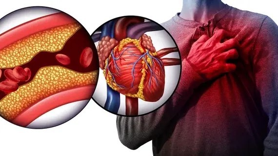 Kaempferol and Quercetin on cardiovascular disease Kaempferol and Quercetin on cardiovascular disease