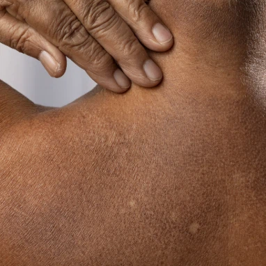 Magnolia Bark Extract For Skin Magnolia Bark Extract For Skin