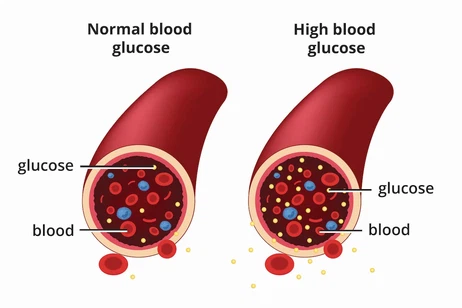 DNJ control postprandial blood sugar DNJ control postprandial blood sugar