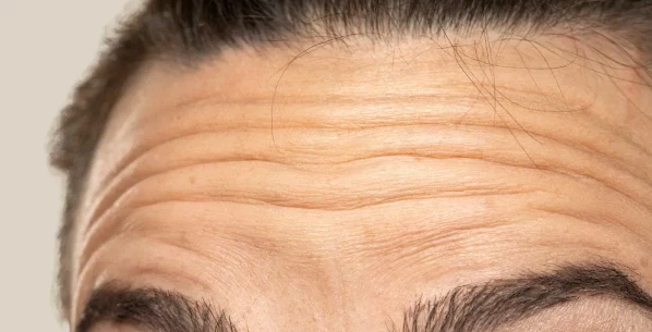 Pro-Xylane Anti-Wrinkle Pro-Xylane Anti-Wrinkle