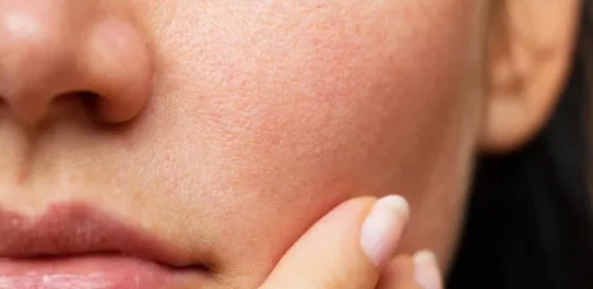 Turkesterone For Skin Turkesterone For Skin